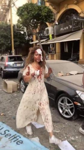 بيروت تنزف 14